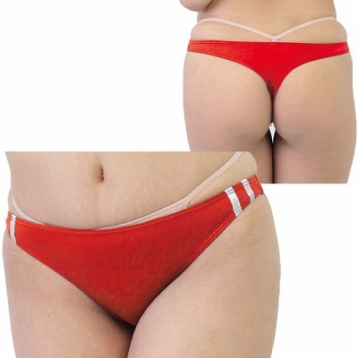 �Q�������X�g���b�`�u���}�s�o�b�N�@���b�h