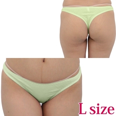 ���Ȃ��݂̗ǂ��R�b�g���V���v���s�o�b�N�k�@�O���[��